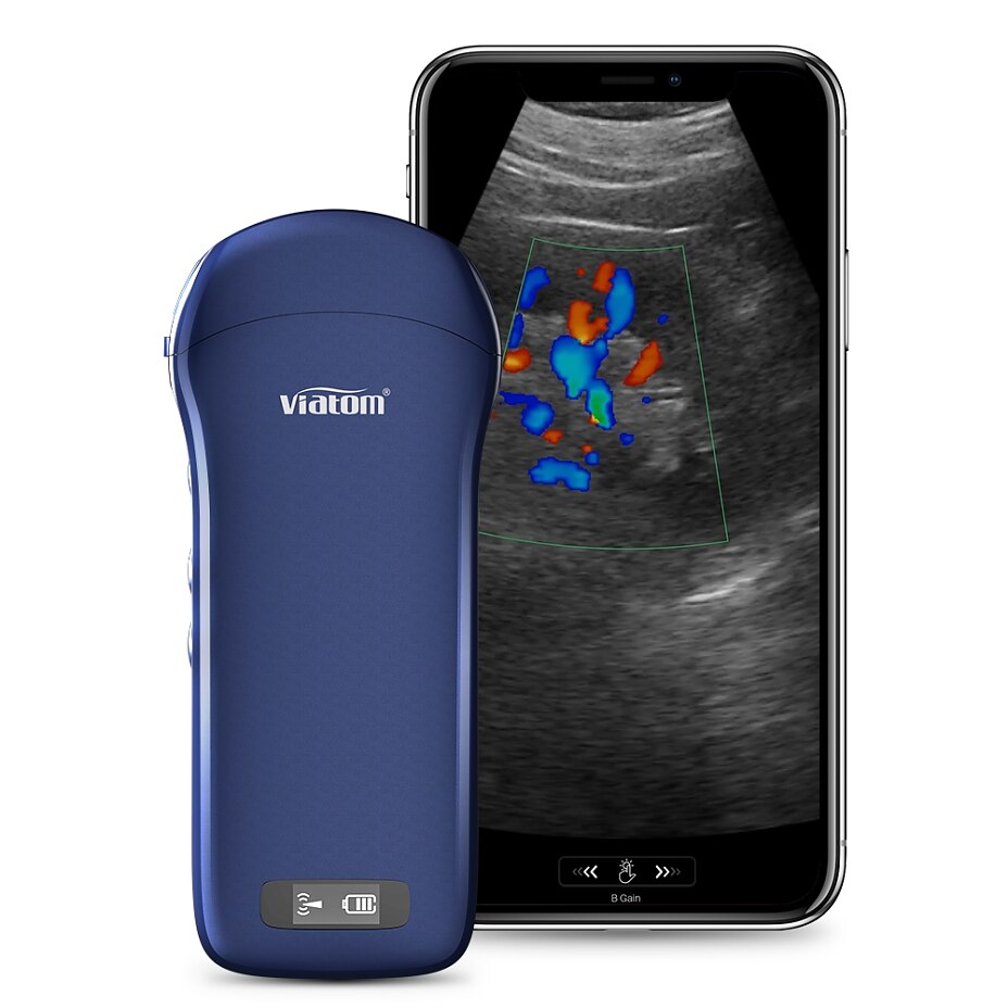 1-c10-3in1ultraschall 1-c10-3in1ultraschall