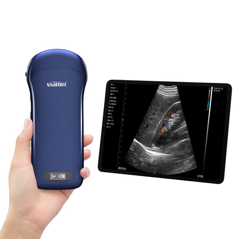 Mobile Ultraschallgeräte  mobiles Ultraschall Diagnosegerät