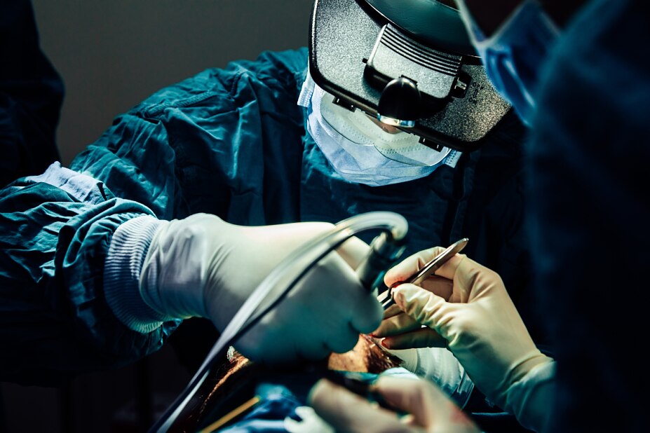 Haartransplantation in Istanbul Eingriff in der Cosmedica Clinic Haartransplantation in Istanbul Eingriff in der Cosmedica Clinic